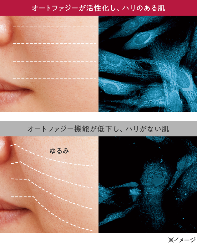 オートファジー比較1